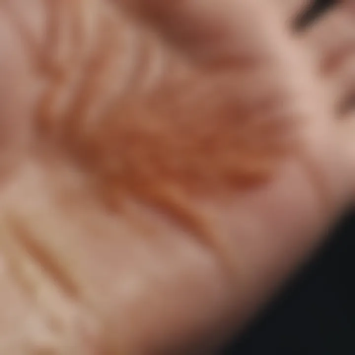 A close-up of a palm showing dry skin and peeling