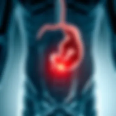 Understanding Umbilical Hernia Illustration of the human abdomen highlighting the area of umbilical hernia.